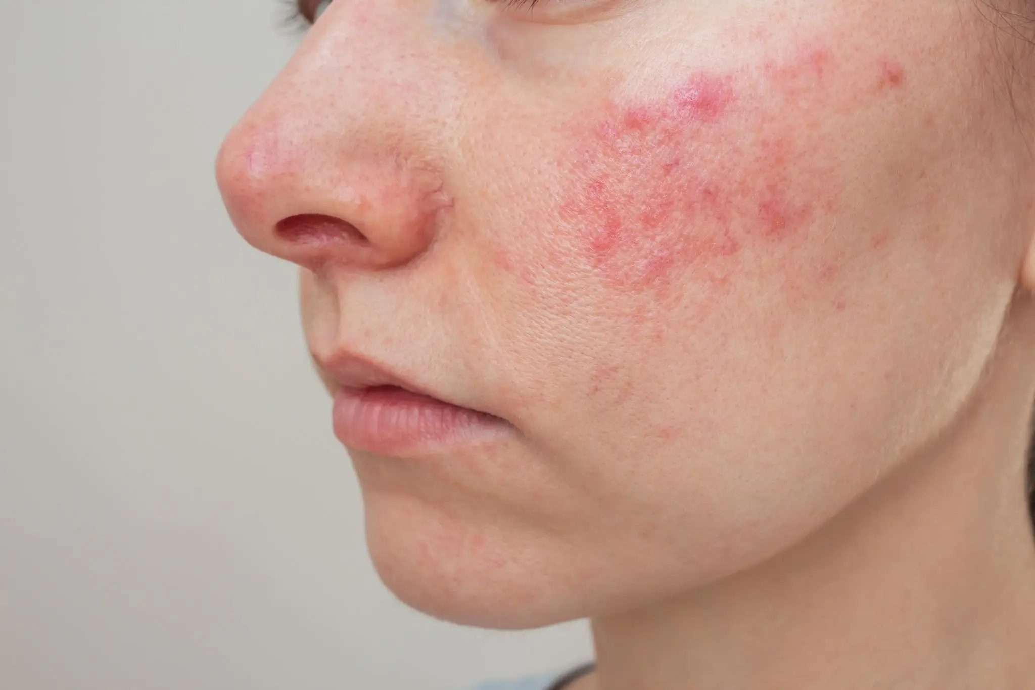 Do you have a persistent rash? Get it checked out. (Getty Stock Images) 