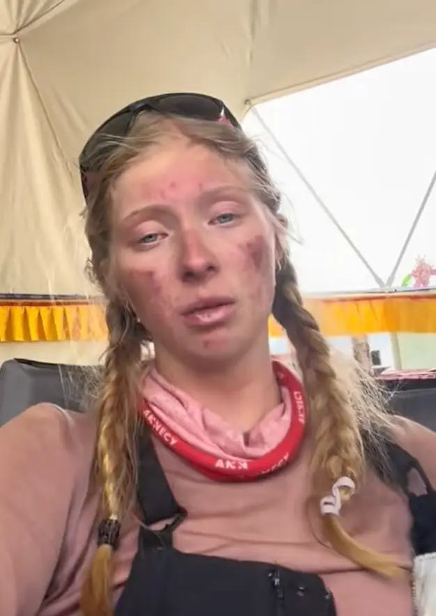 Bianca's body couldn't handle the conditions despite being just 400m from the summit (TikTok/biancaaadler)