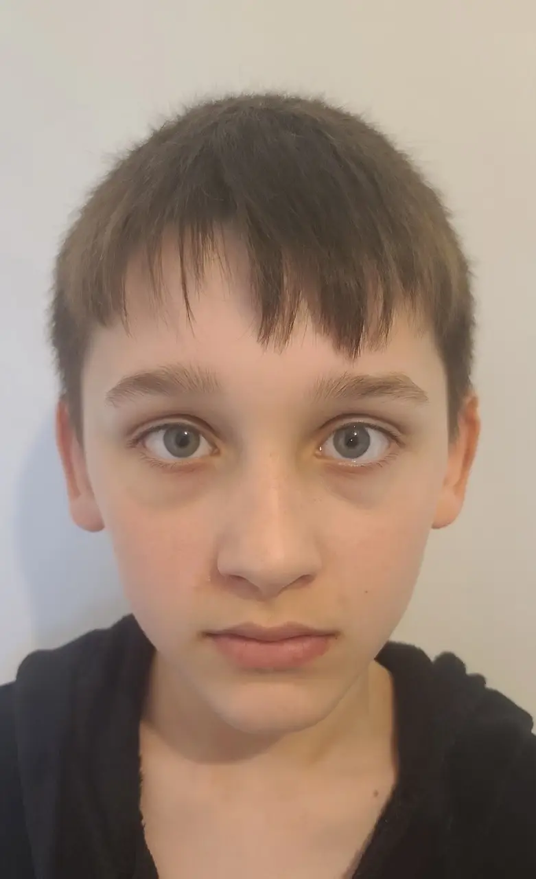 Harry before his haircut. (SWNS)