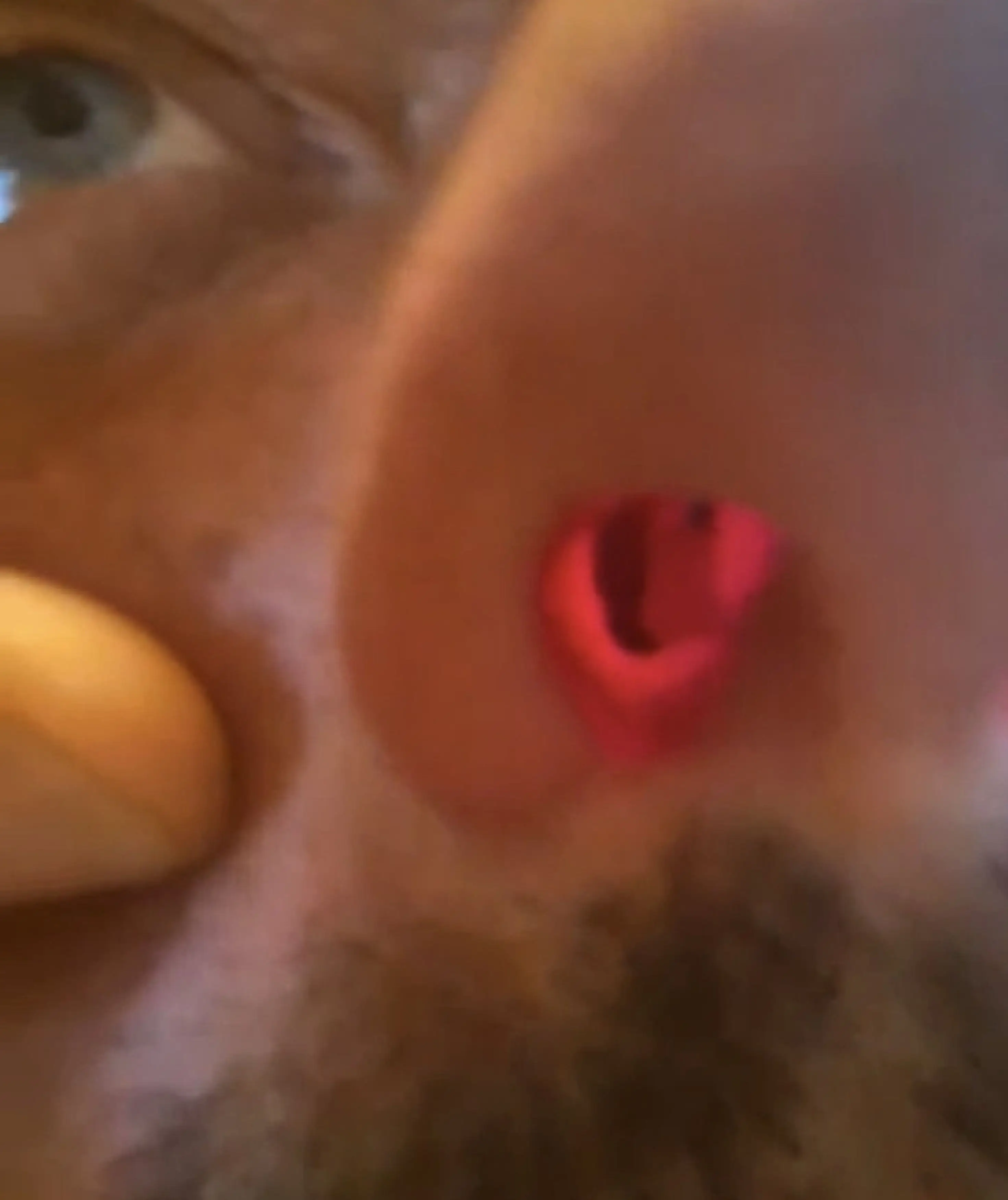 He had a hole in septum (Kennedy News and Media)