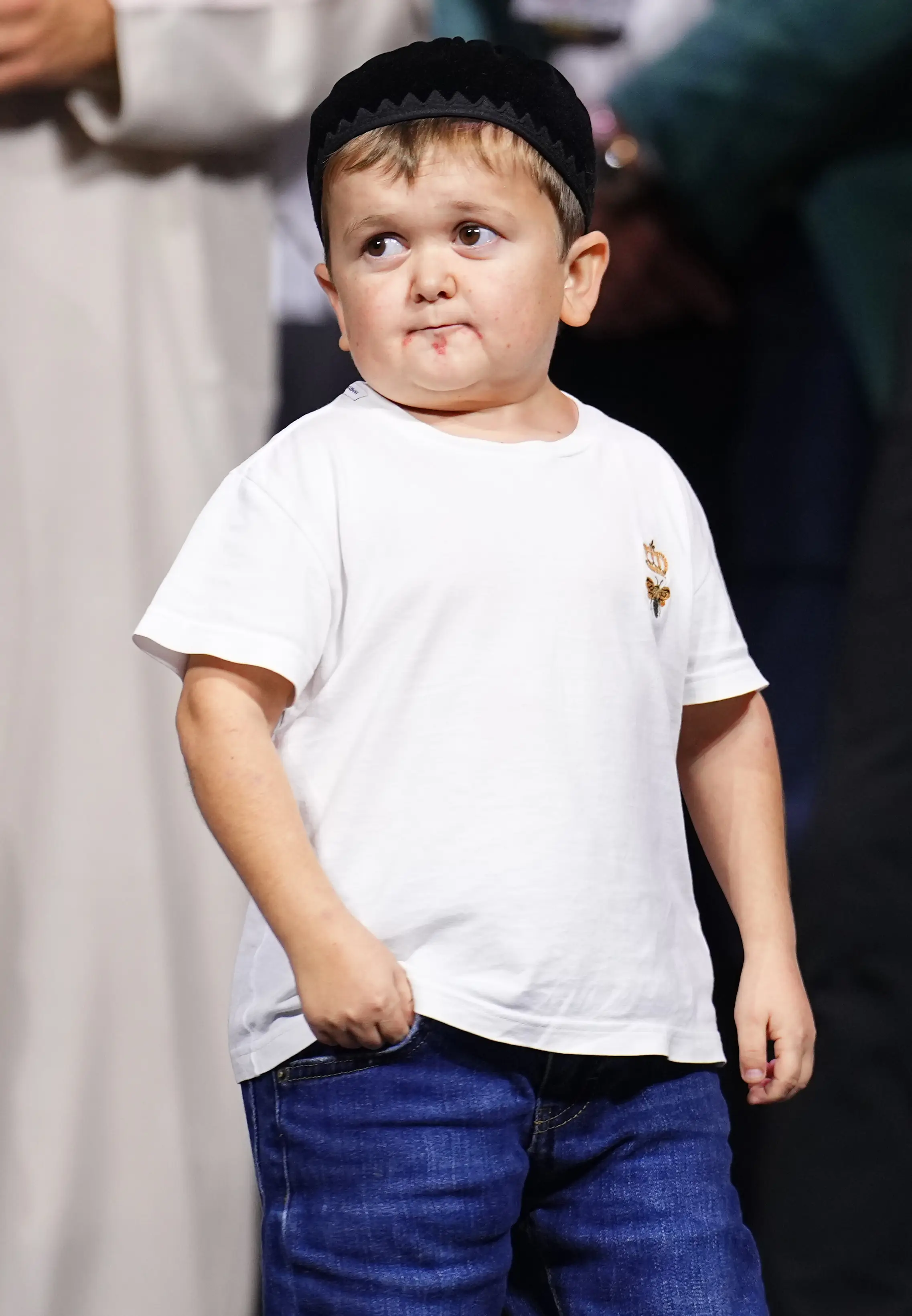 Hasbulla hasn't spoken about it much himself, but doctors say he is likely to have Growth Hormone Deficiency (Chris Unger/Zuffa LLC / Getty Images)