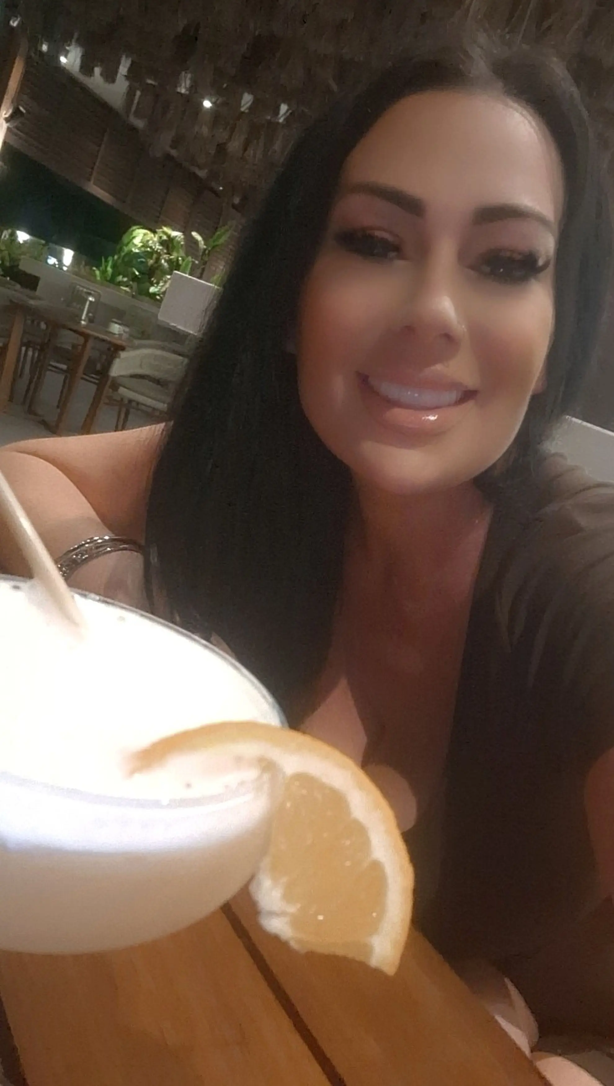 Jackie wanted to get her teeth fixed after suffering dental issues from a chemical menopause, not realising she'd spend £18,000 on a months-long ordeal (Kennedy News and Media)