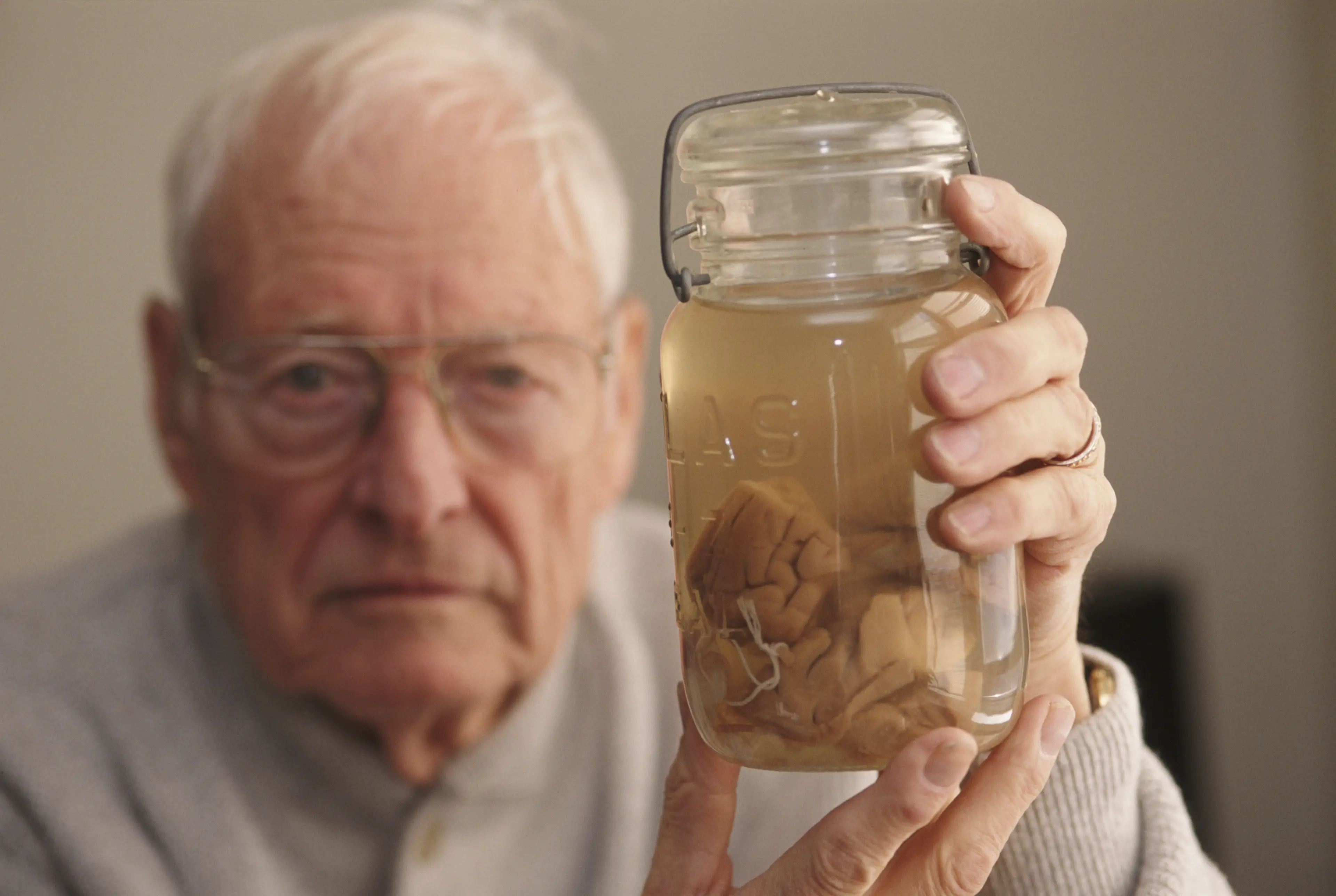 Thomas Stoltz Harvey pictured in 1994 holding part of Einstein's brain which he'd kept with him for decades (Michael Brennan/Getty Images)