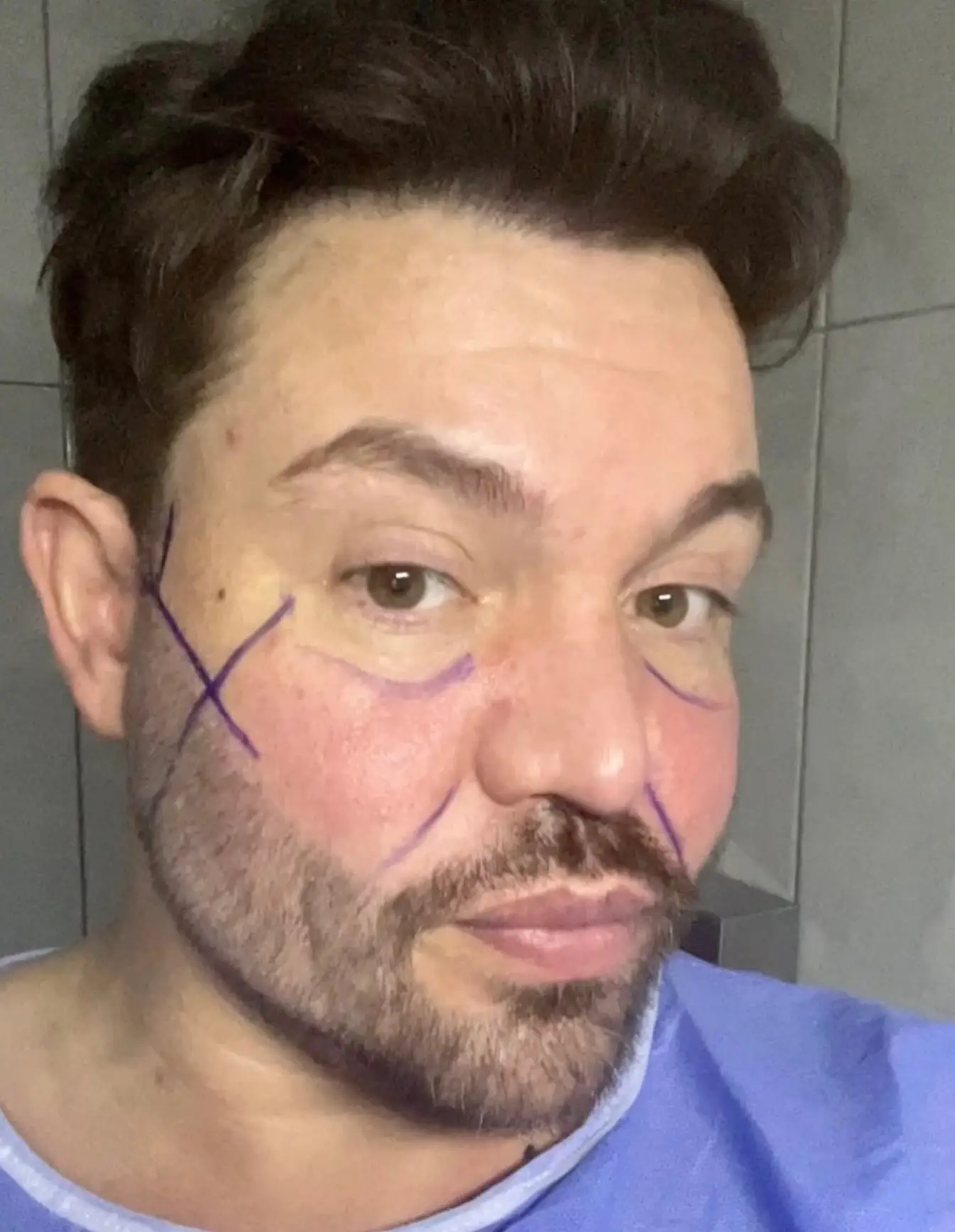 He has been sharing the details of the procedures and his recovery with fans on social media (Instagram/@bobbycnorris)