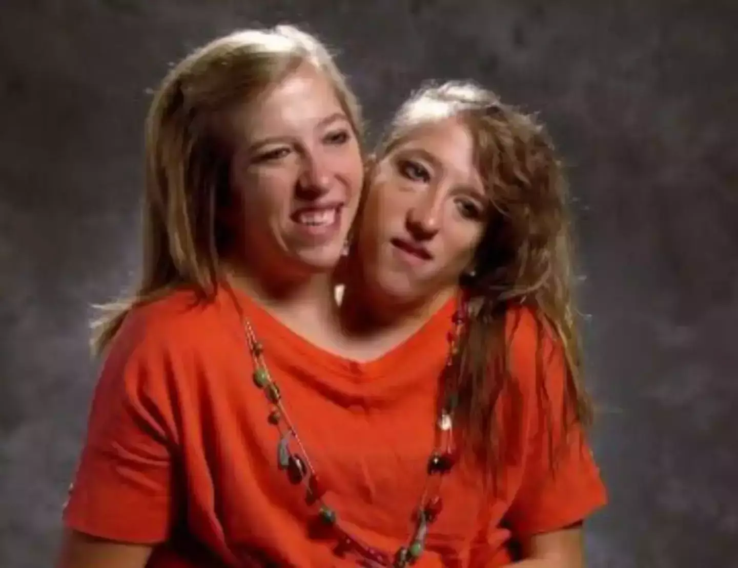 Abby and Brittany Hensel are conjoined twins (TLC)