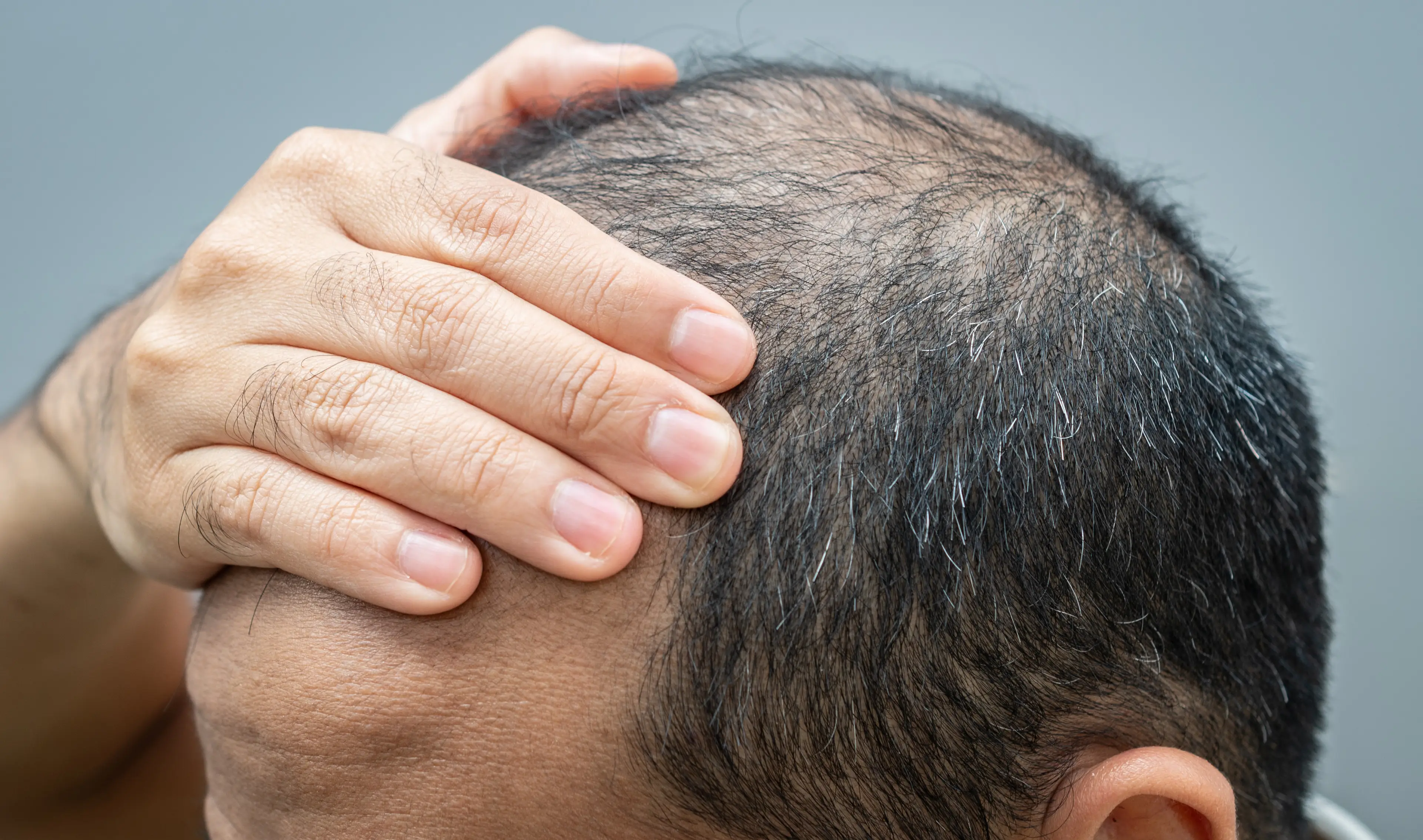 The study found no link between creatine and hair loss (Getty Stock Images)