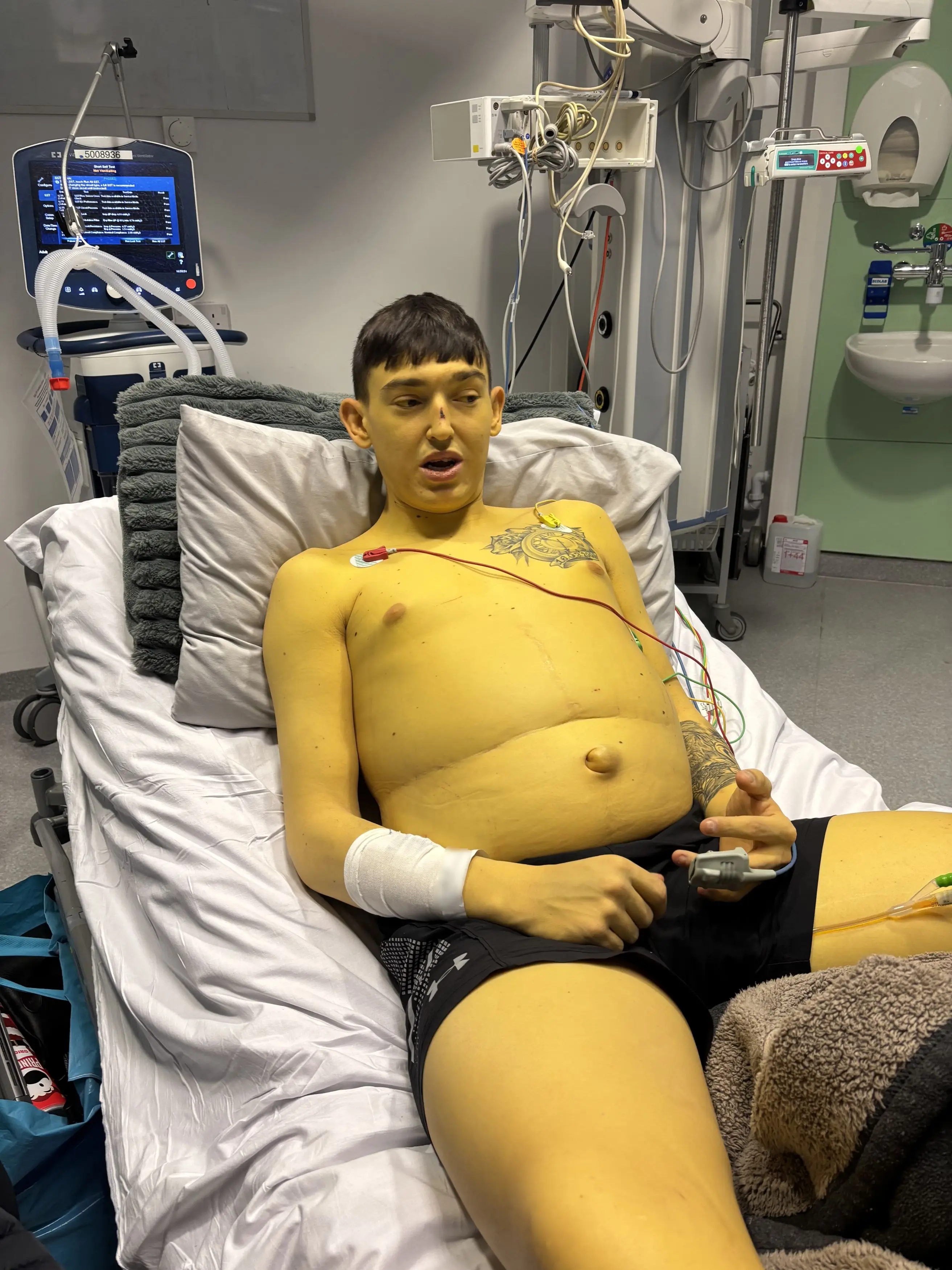 He says he looked like one of the Simpsons. (Kennedy News and Media)
