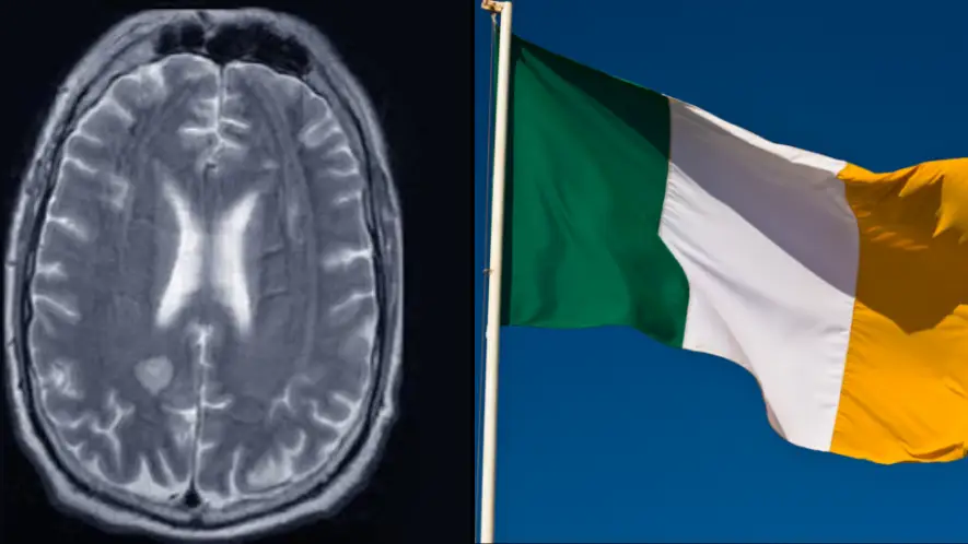 BMJ Case Report, 2023 / Paul Thompson Images / Alamy