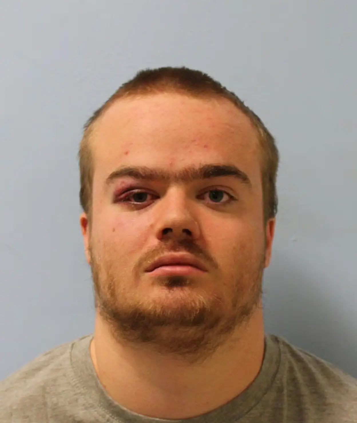 The 24-year-old has now been found guilty of attacking two nurses at Broadmoor (PA)