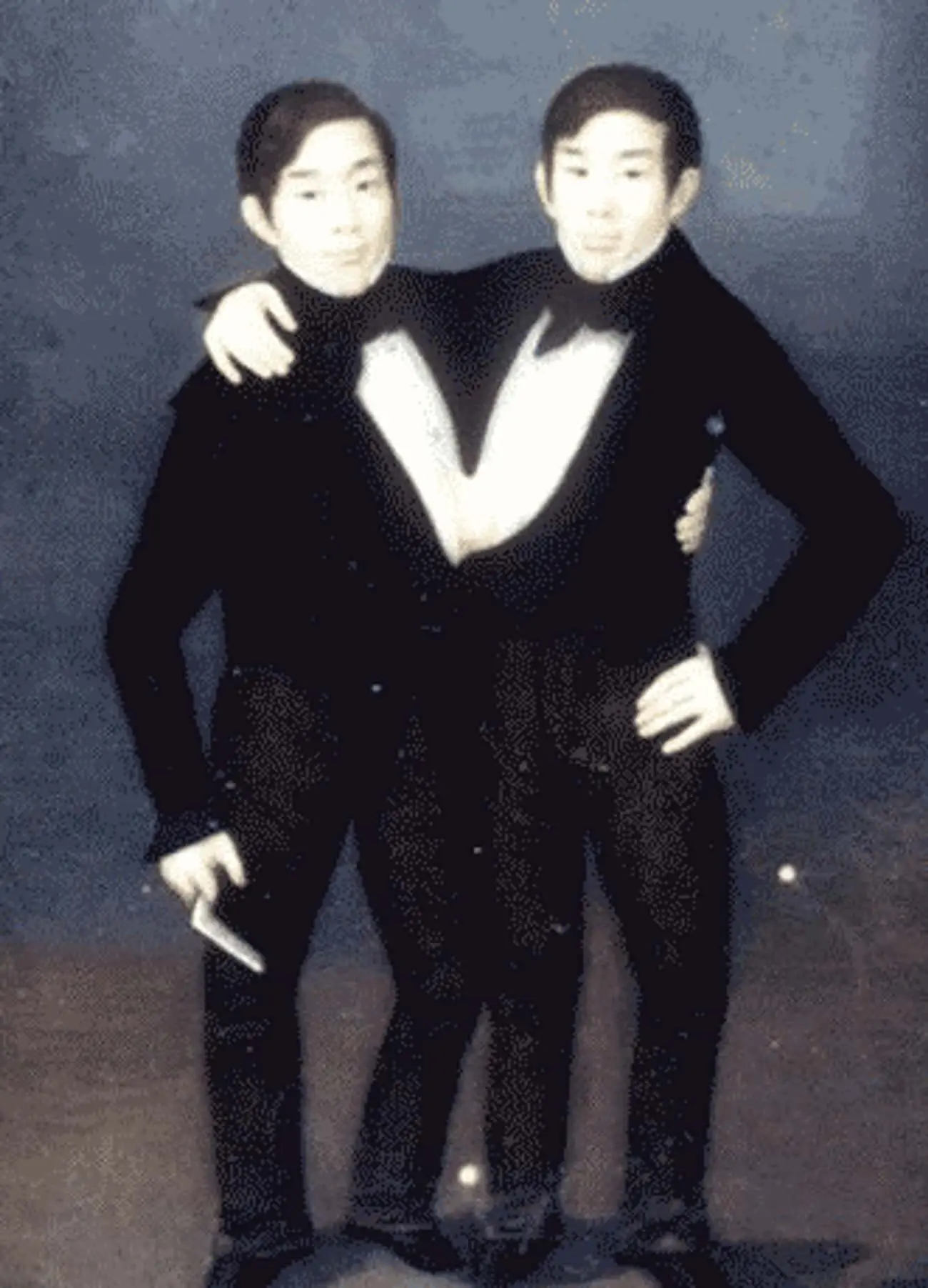 The infamous Siamese twins, Chang and Eng Bunker. (CatherineMunro/Wikimedia Commons/Public Domain)