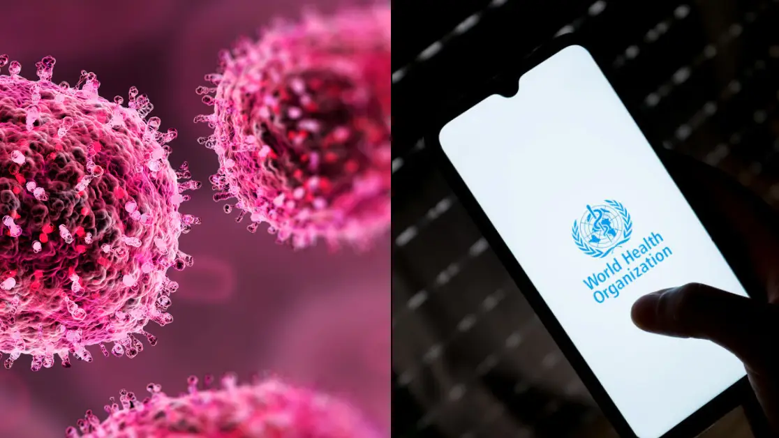 Sergio Iaremenko/Science Photo Library/Getty Images/Nikolas Kokovlis/NurPhoto via Getty Images