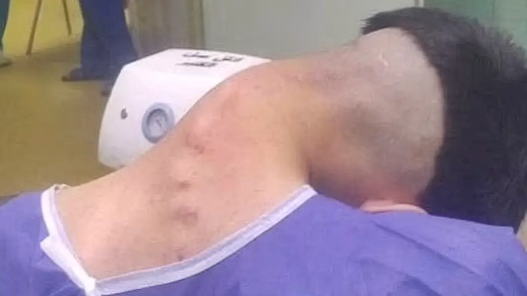 Neurosurgery data from Iran's Isfahan Medical University