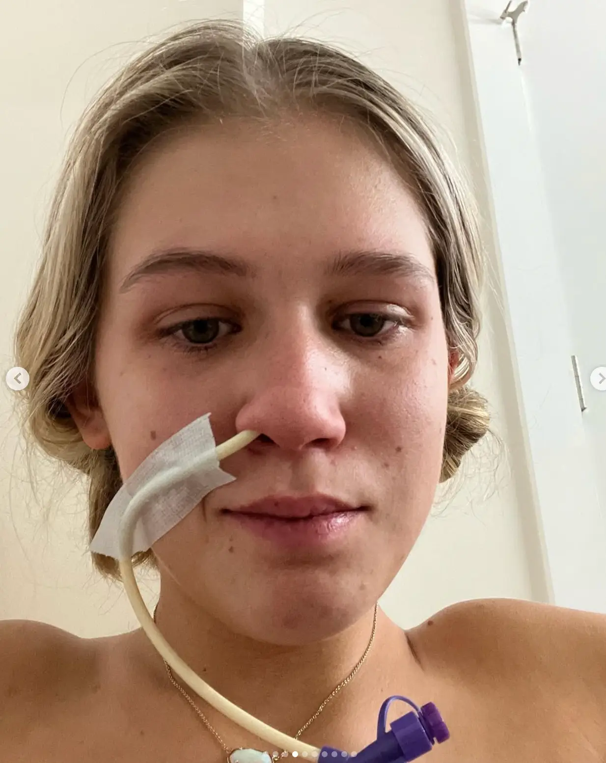 Sydni was hospitalised after being unable to eat (Instagram/sydnicollinsss)