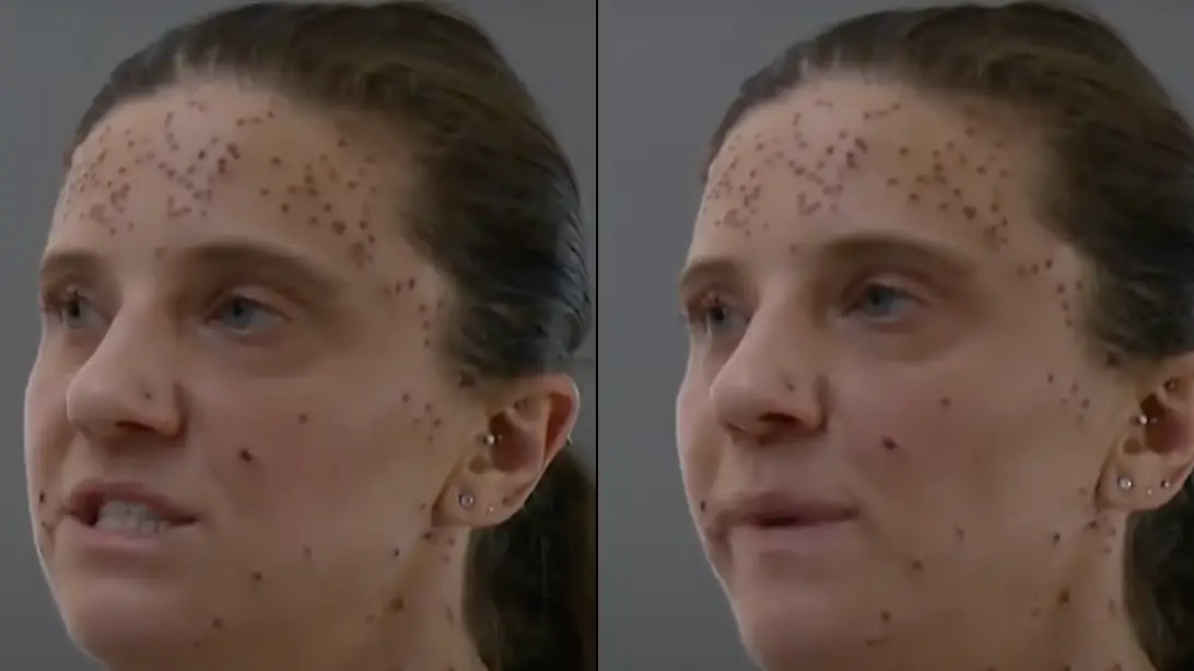 'Humiliated' nurse claims she was kicked off plane after 'concerns' were raised over rare skin condition