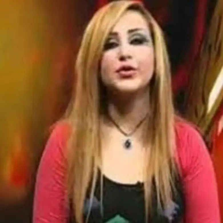 Dalia before the surgeries (CEN)