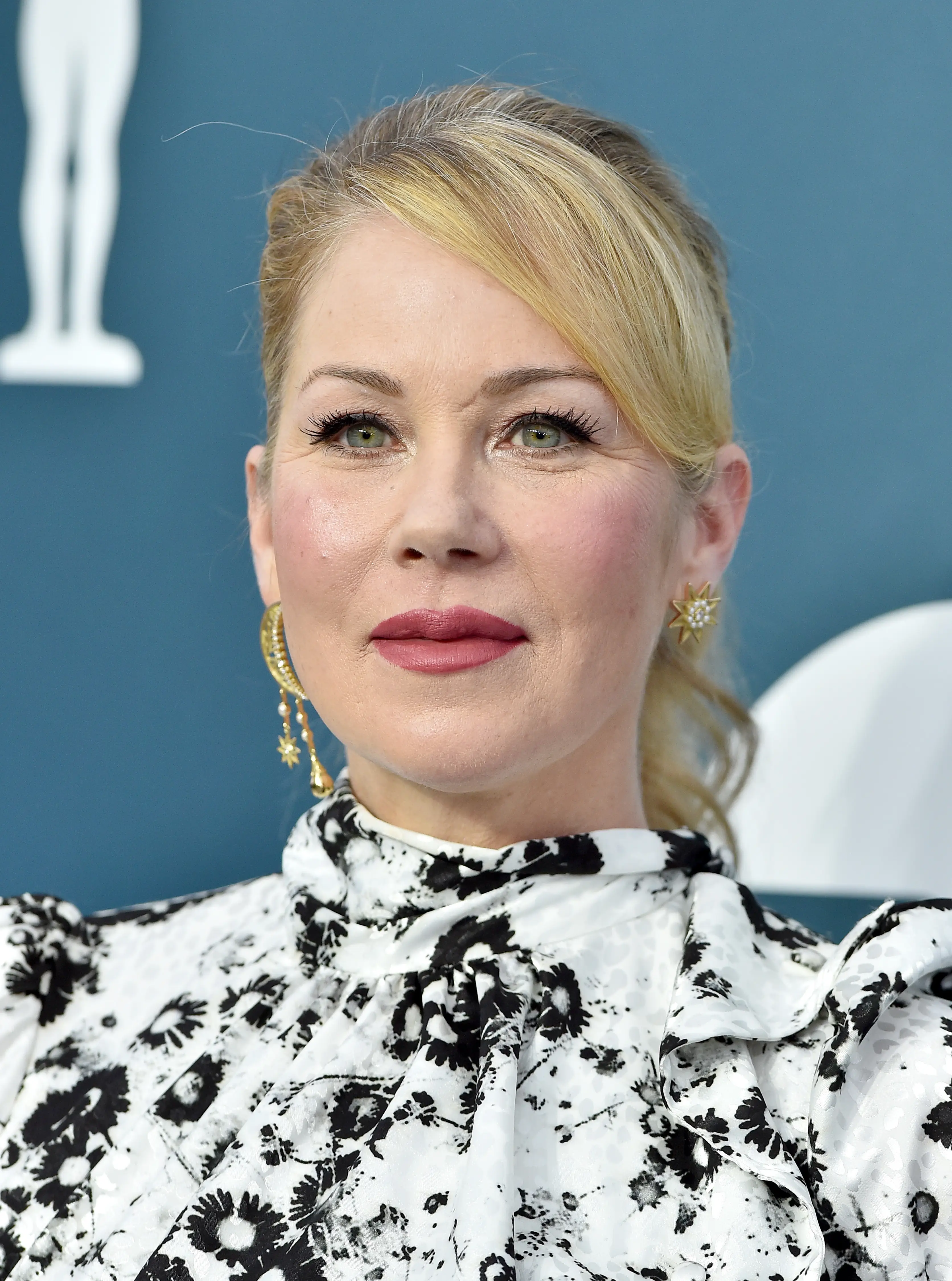 The actress revealed MS has left her with 30 lesions on her brain. (Gilbert Flores/Variety via Getty Images)