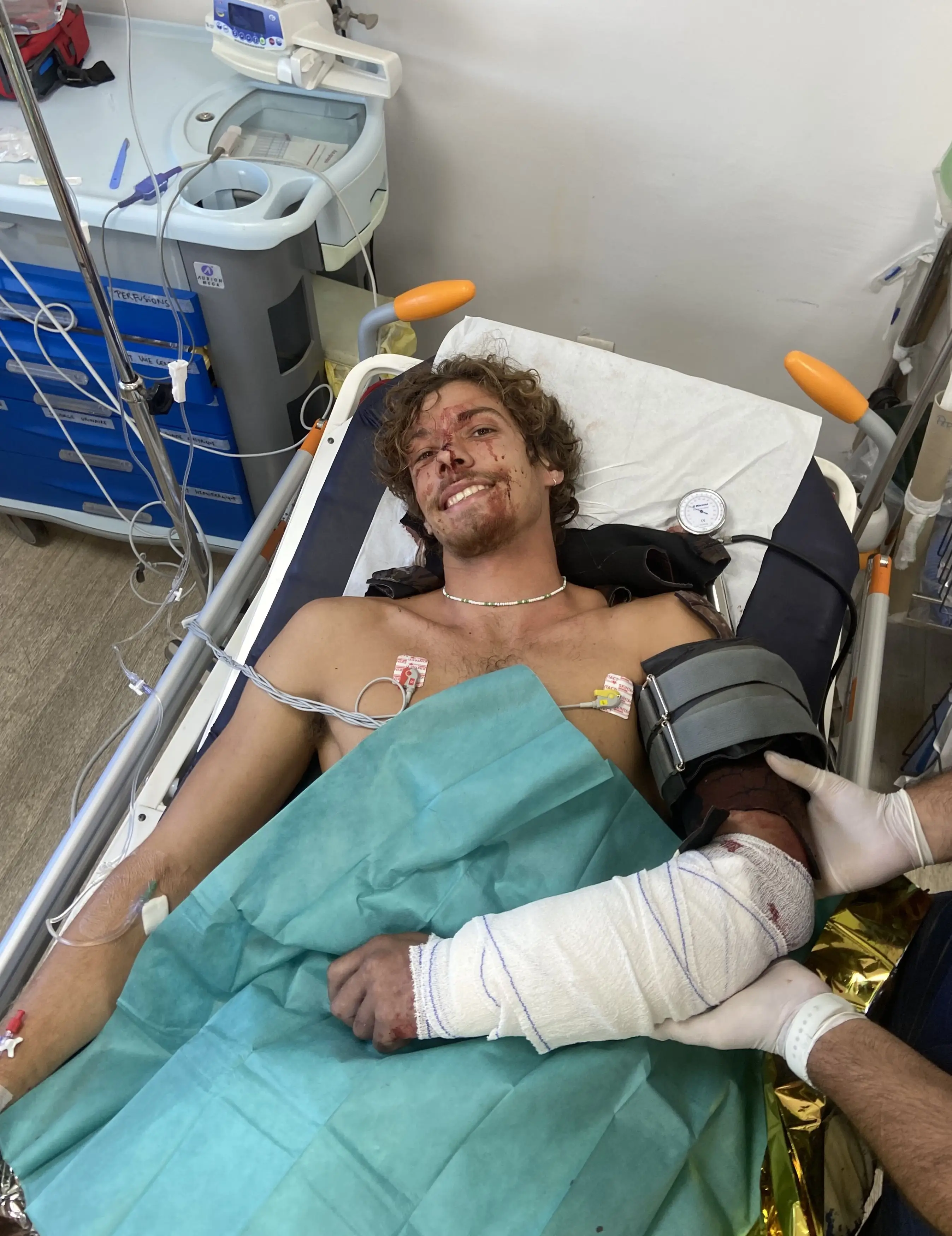 Angus was lucky to be alive. (Kennedy News and Media)