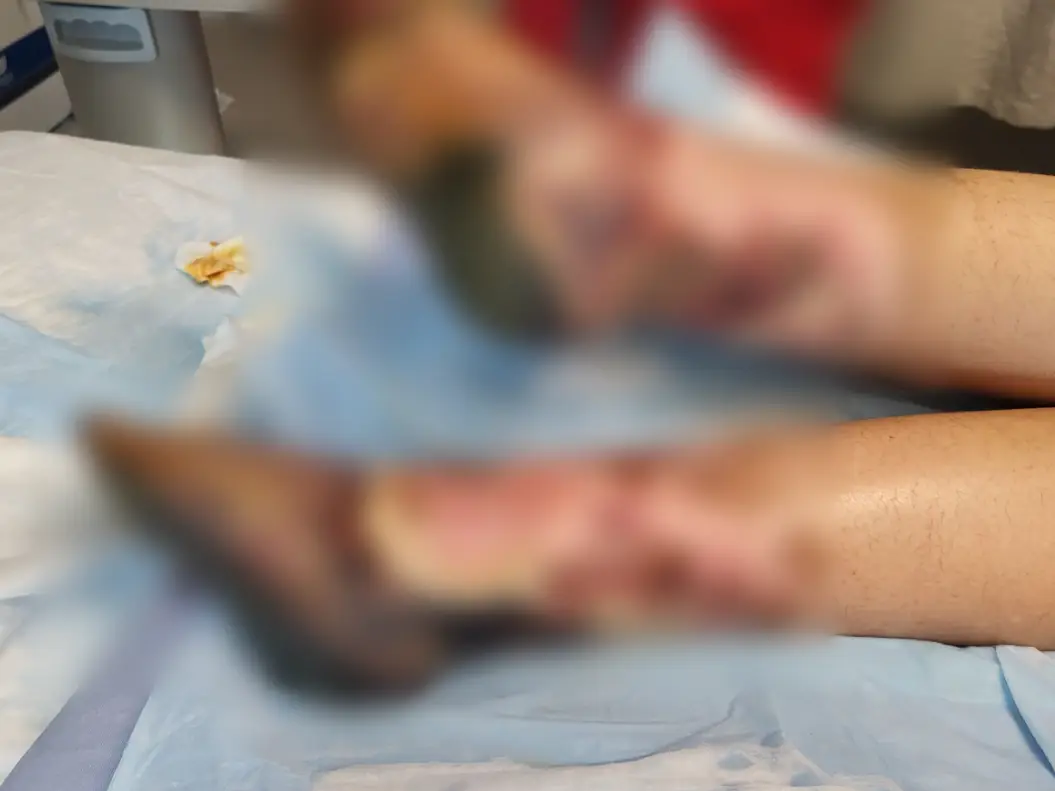 Her feet became infected after her arms, but they all needed to be amputated (Kennedy News and Media)