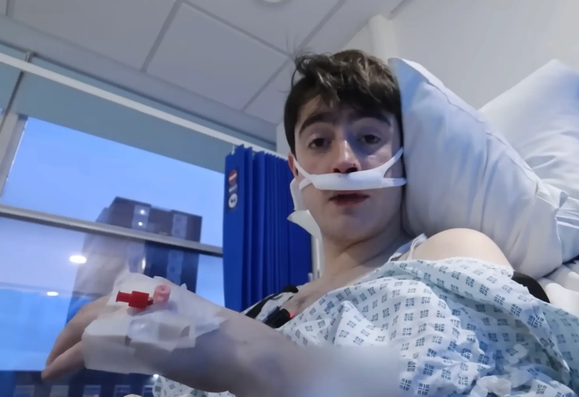 James underwent the procedure on his nose last year (YouTube/James Chewbonic)