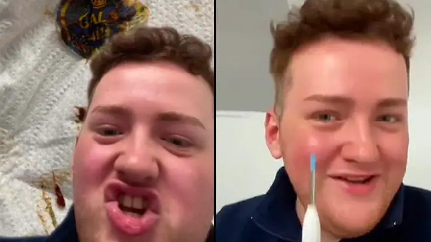 Man accidentally discovers apple sticker in ear that had been there for years