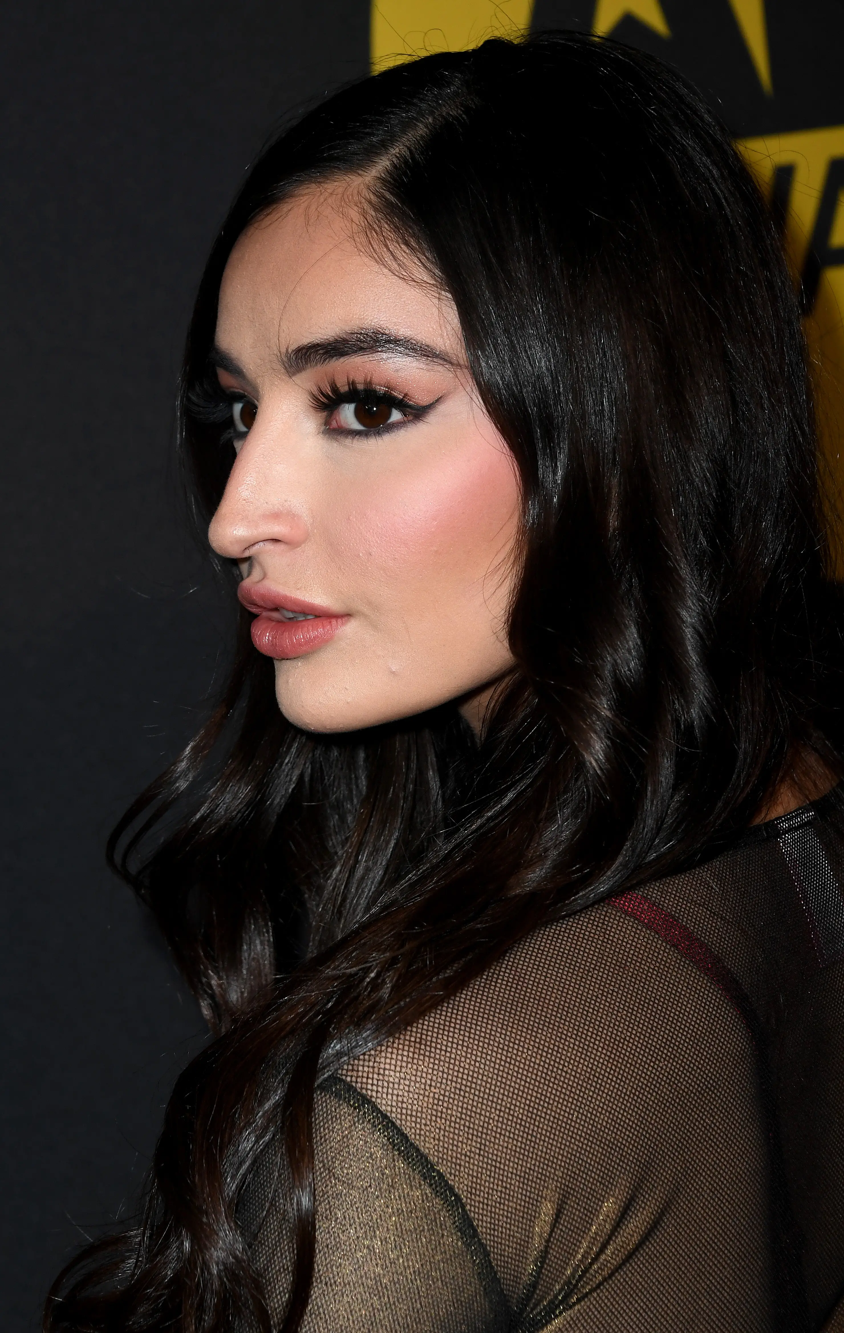 Willis now suffers from locked-in syndrome where she can only move her eyes (Albert L. Ortega/Getty Images)