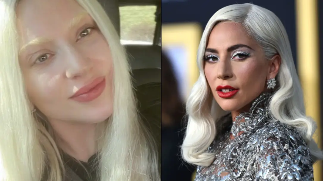 Instagram/@‌ladygaga/Neilson Barnard/Getty Images