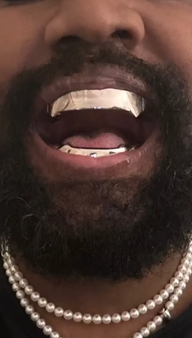 Kanye West showed off his new dental work on social media.