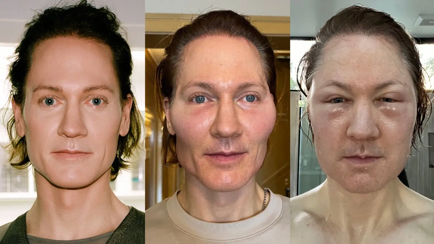 'Project Baby Face' didn't go to plan initially (X/@bryan_johnson)