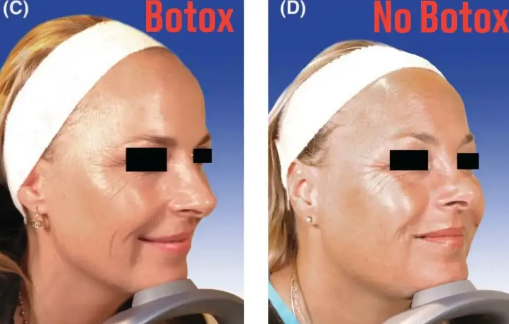 The snaps speak for themselves (American Society for Dermatologic Surgery)