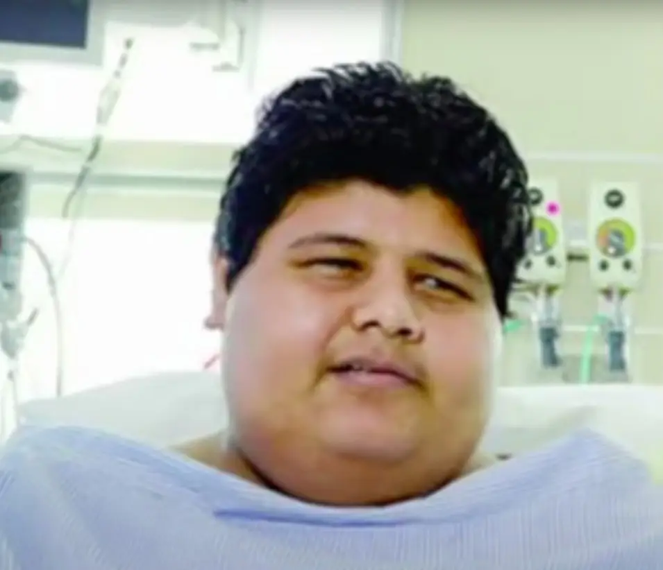 Khalid before his weight loss journey.