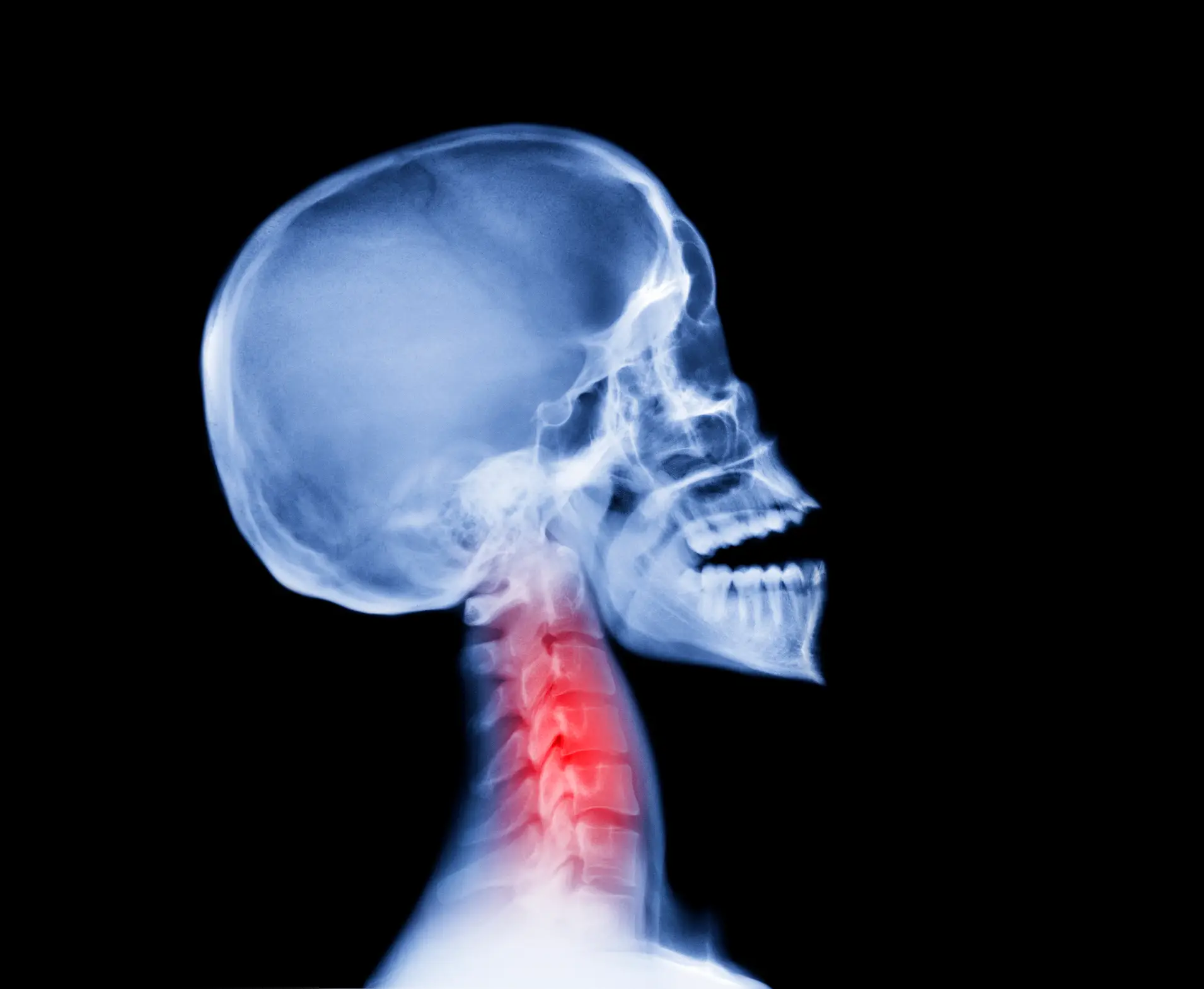 X-ray vision is an unheard of phenomenon (Getty Stock Image)