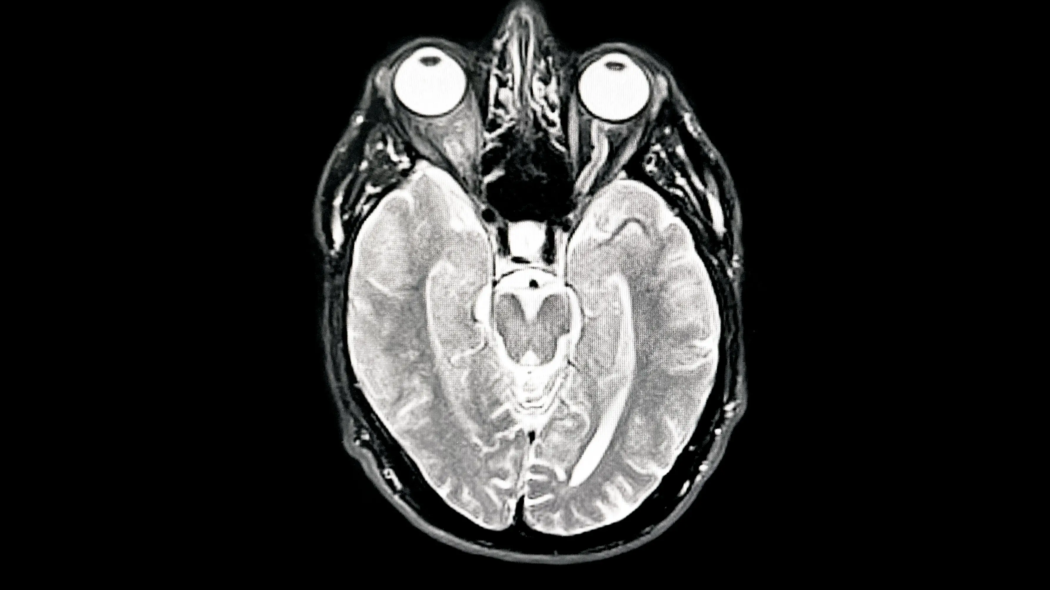 Peter Dazeley/Getty Images