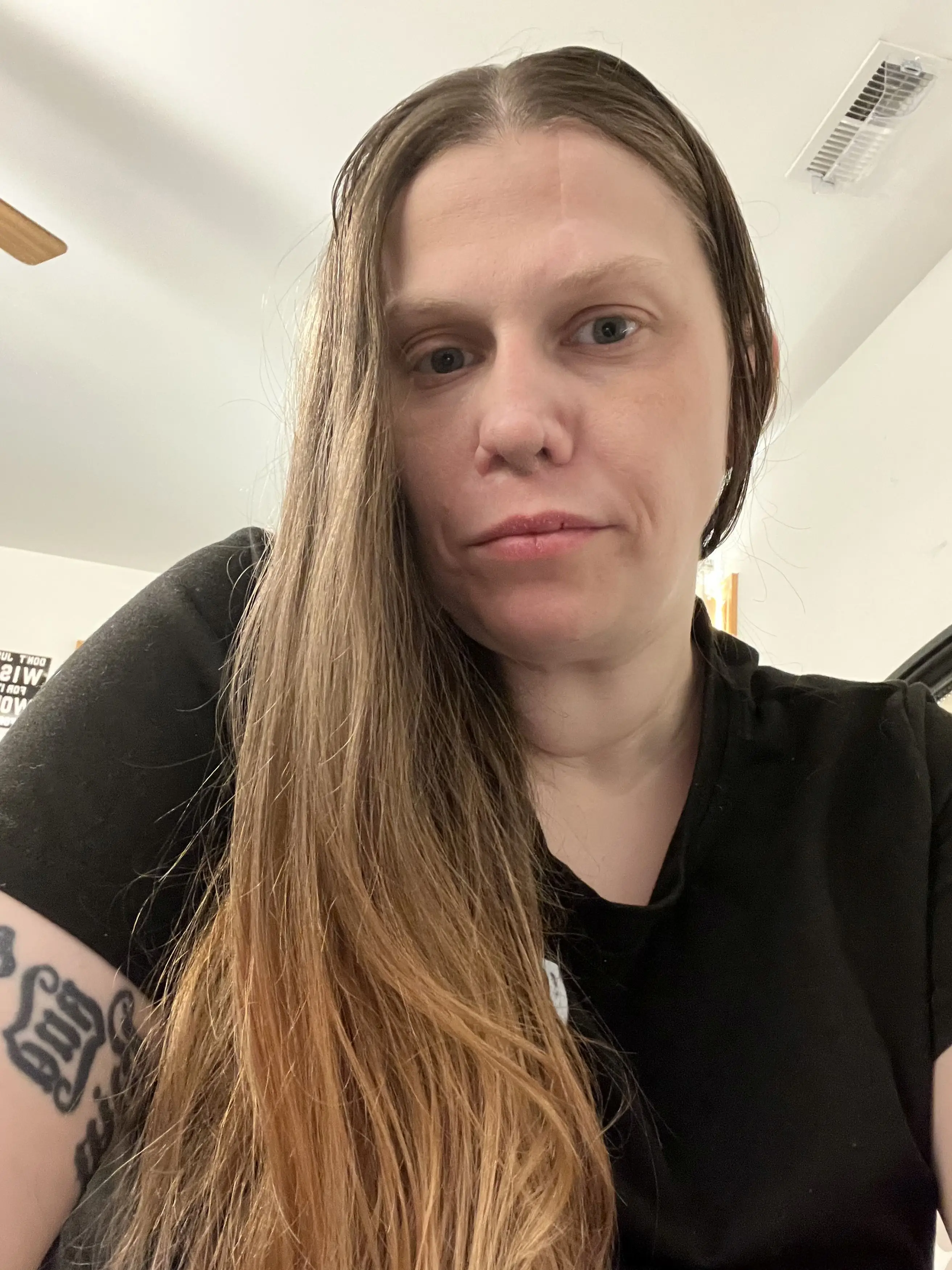 She has since undergone extensive surgery (Kennedy News and Media)