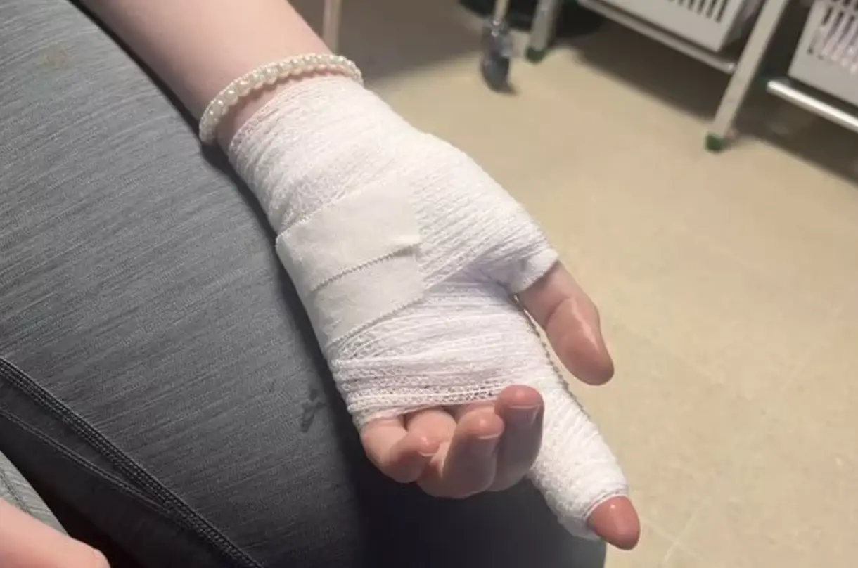 She suffered horror burns and required treatment. (Kennedy News and Media)