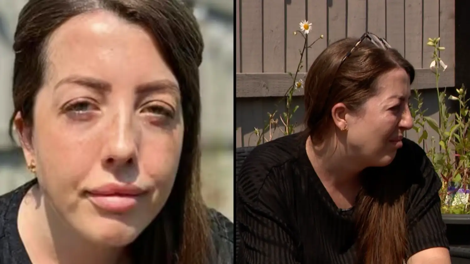 Woman left disabled when surgeon 'experimented' on her says she was his 'guinea pig'