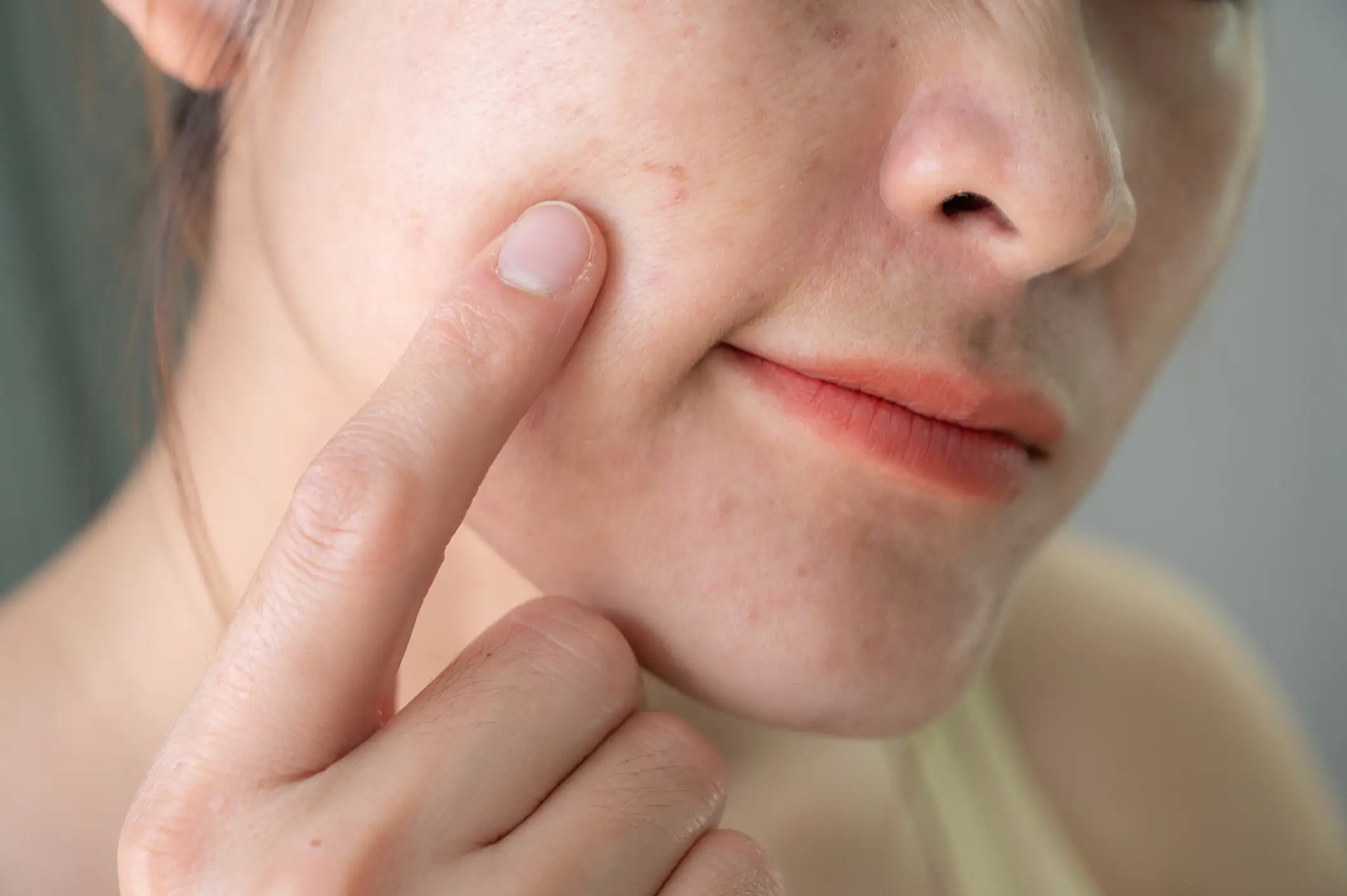 You shouldn't pop spots in the 'triangle of death' (Getty Stock Photo)