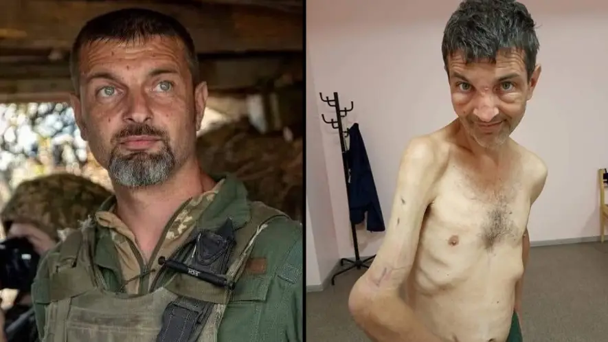 Ukraine prisoner of war shows shocking toll captivity had on his body