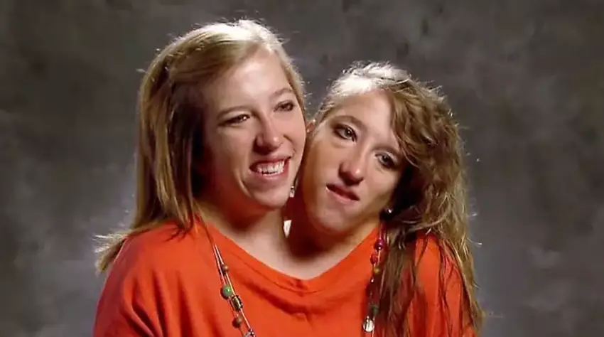 The sisters have addressed previously how their body functions (TLC)