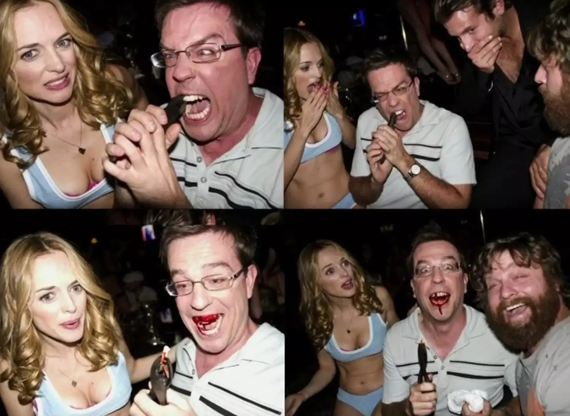 Helms removed his actual tooth.