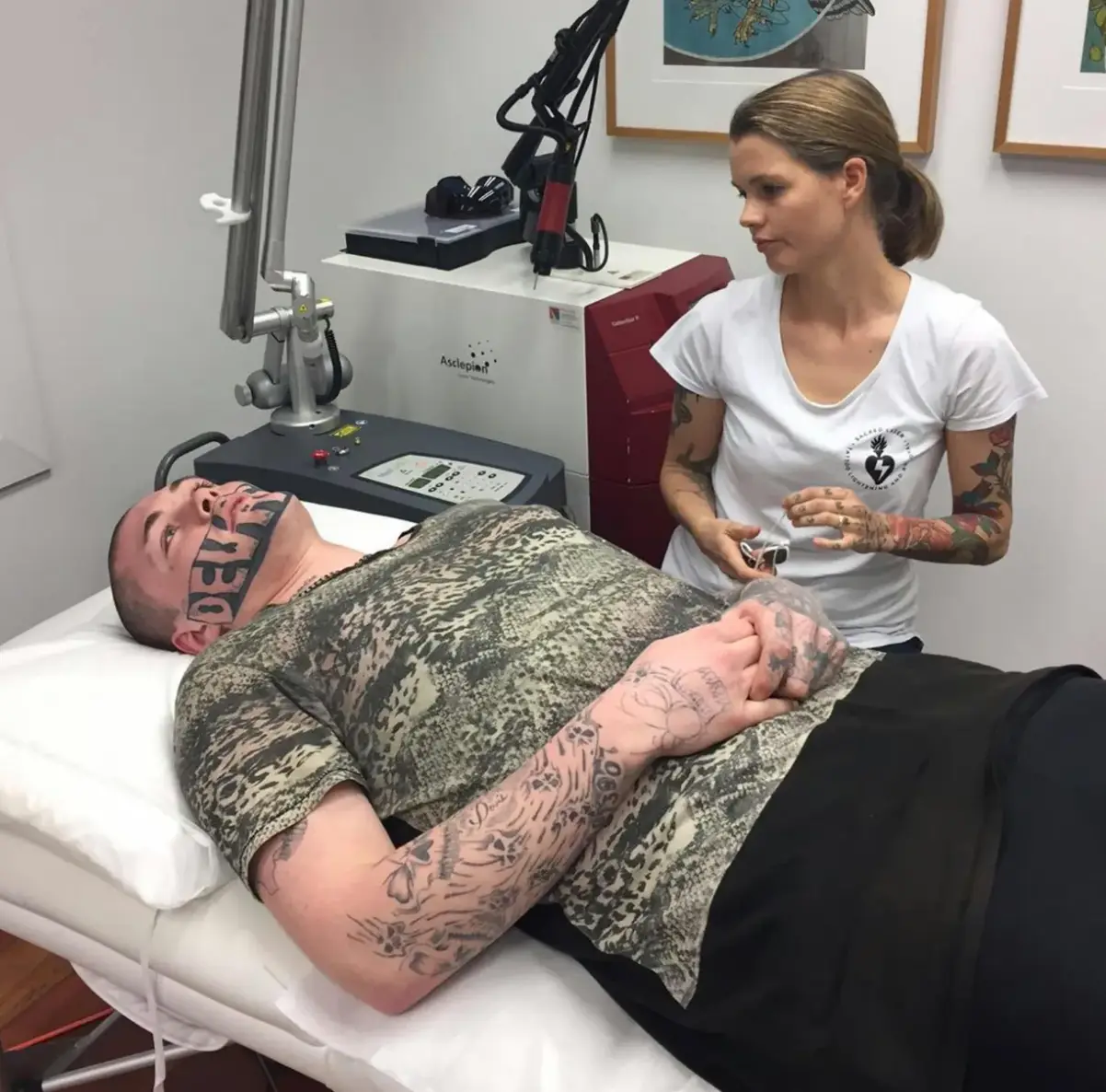 Mark Cropp underwent just one session of laser removal in the end (Caters News Agency)