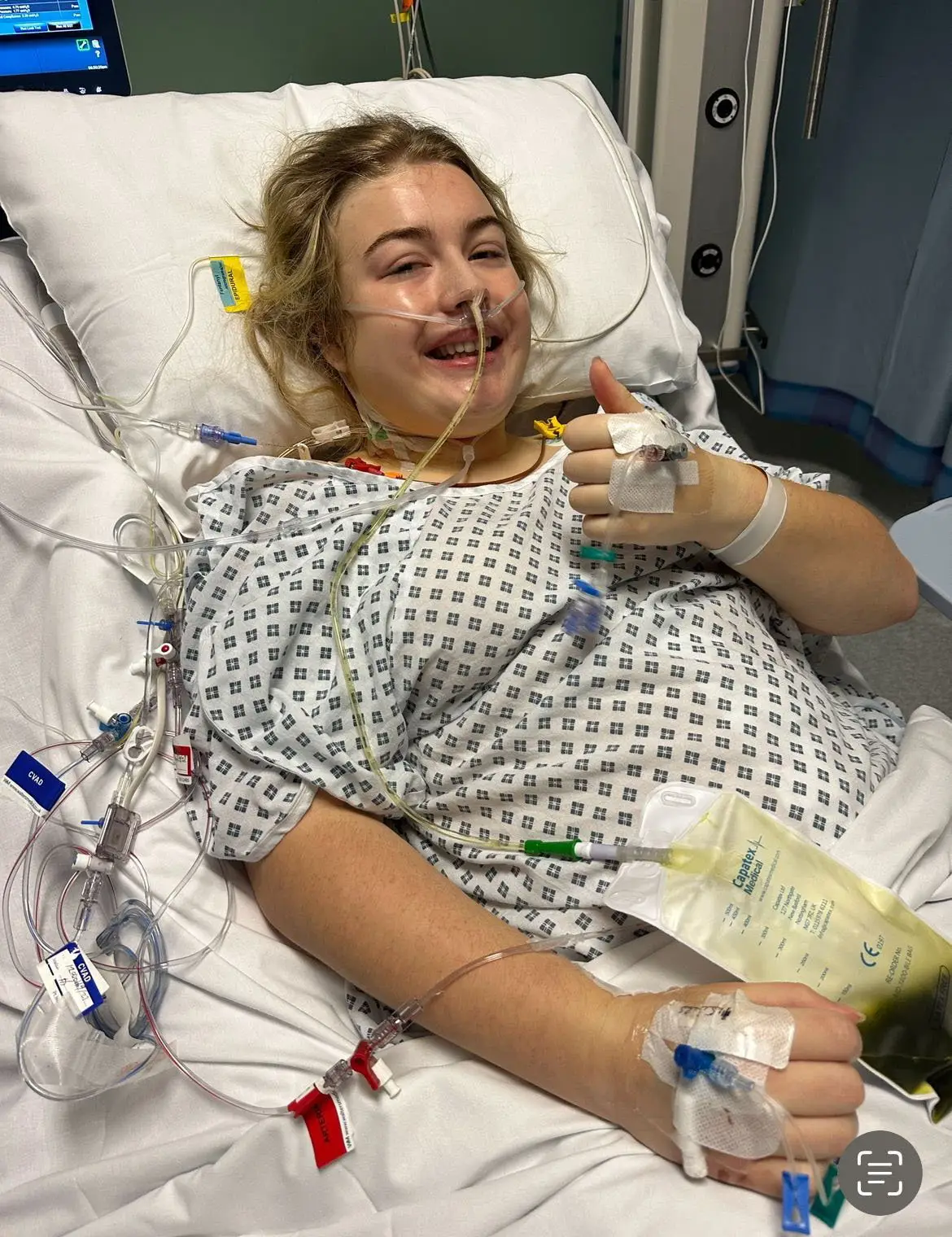 The family later discovered that the 20-year-old was suffering from adrenocortical carcinoma. (SWNS)