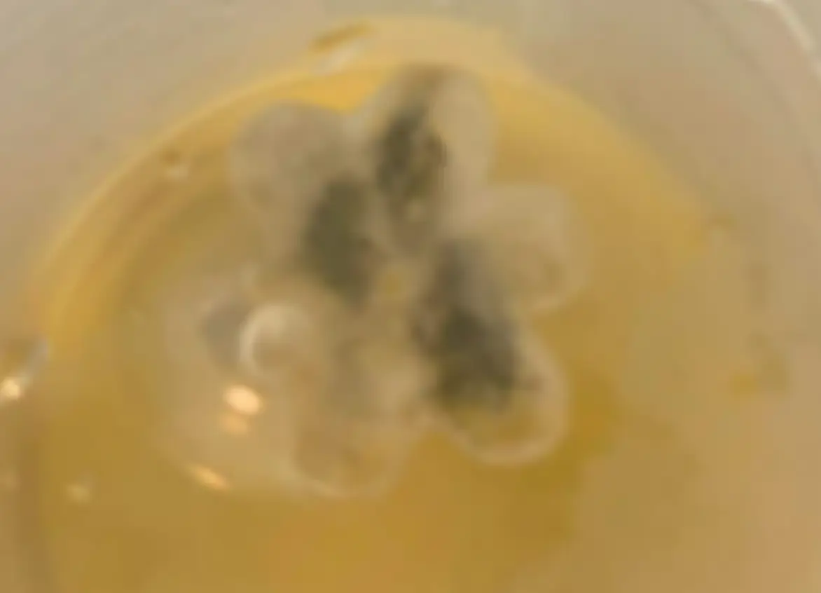 Doctors discovered a small plastic flower lodged in Marley's throat.