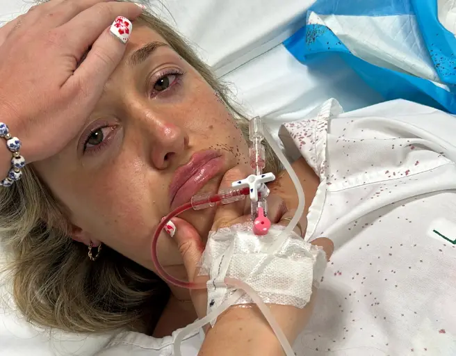 Rachel hopes to have full movement in her fingers and hands in 18 months' time (SWNS)