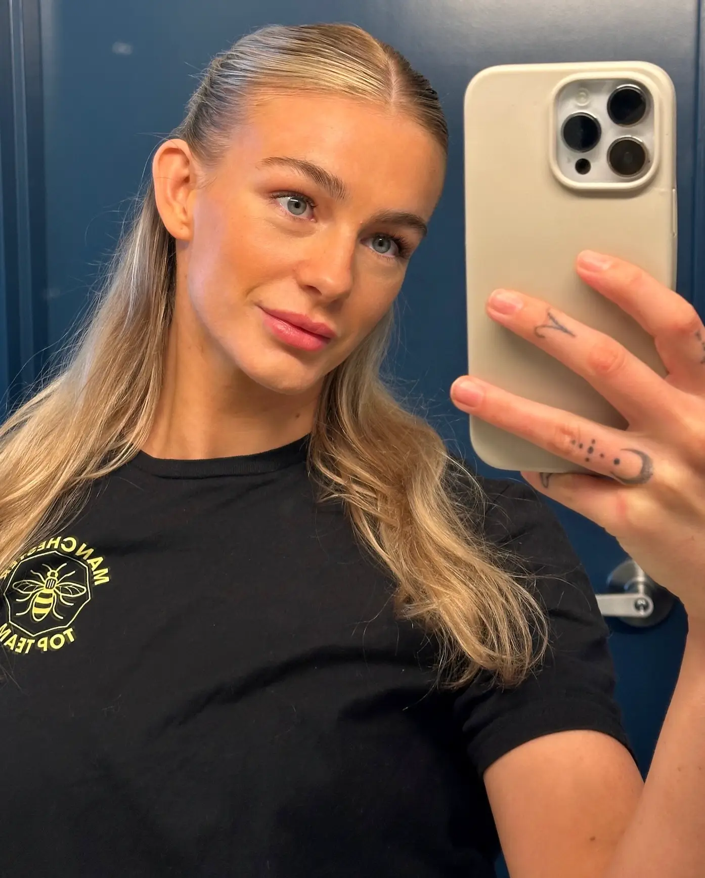 Sammy-Jo first started suffering at 14. (SWNS)