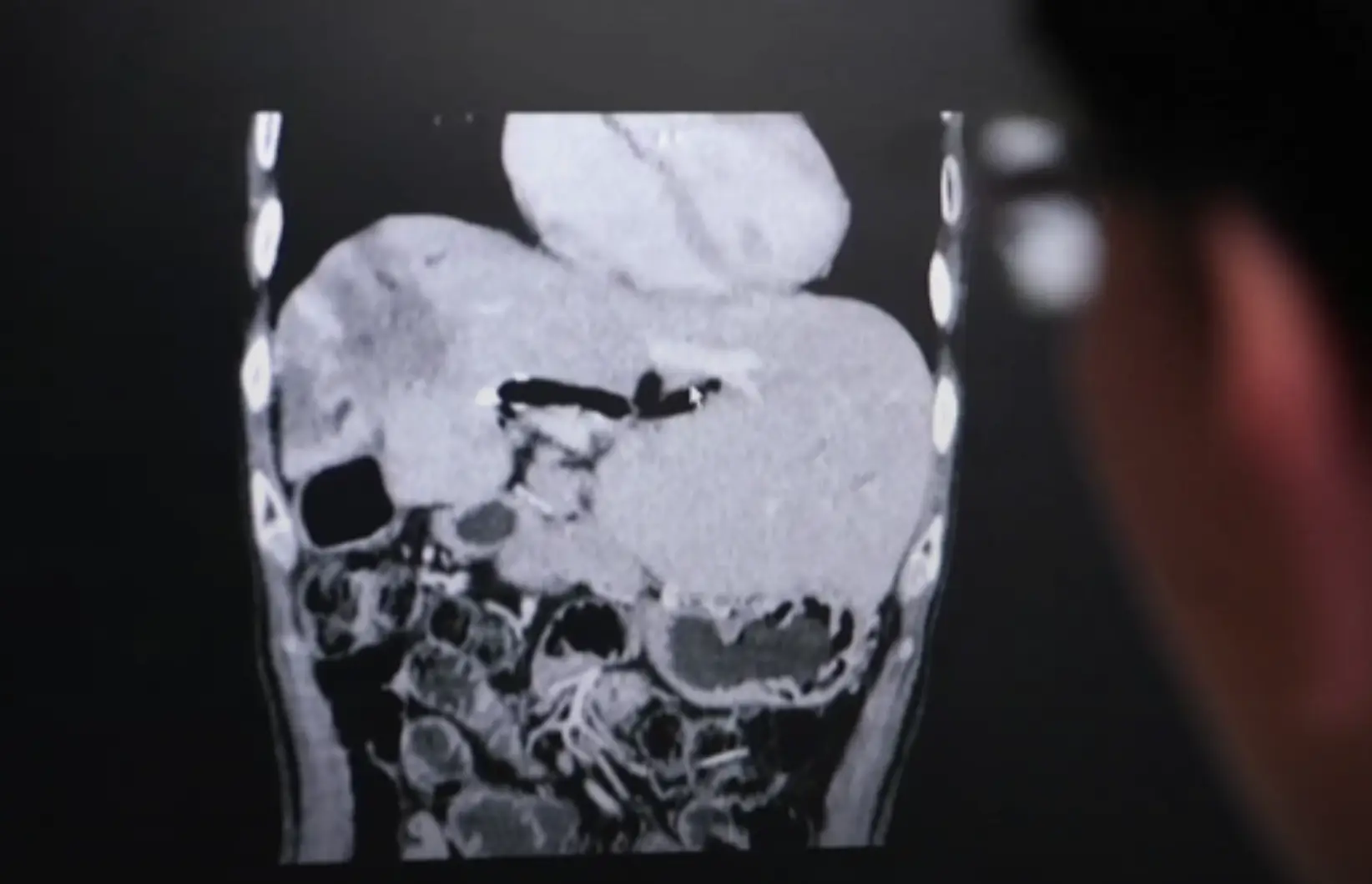 It's a dangerous dish, but some people don't want to change their eating habits (BBC)