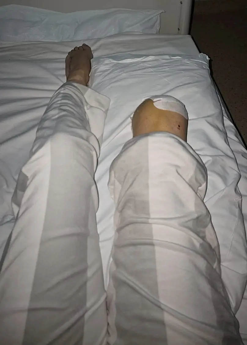 Danielle is now worried that her amputation has left her 'vulnerable' and an 'easy target' for people (SWNS)