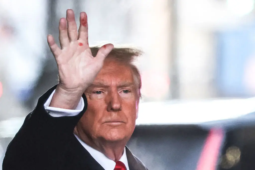 Strange red marks appeared on Trump's hands (CHARLY TRIBALLEAU/AFP via Getty Images)