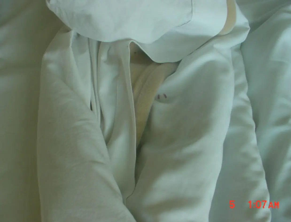 Blood on George's bedsheets raised suspicions as to what actually happened. (Royal Caribbean)