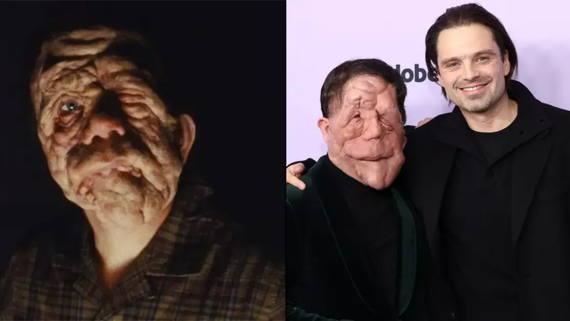 A24/Matt Winkelmeyer/Getty