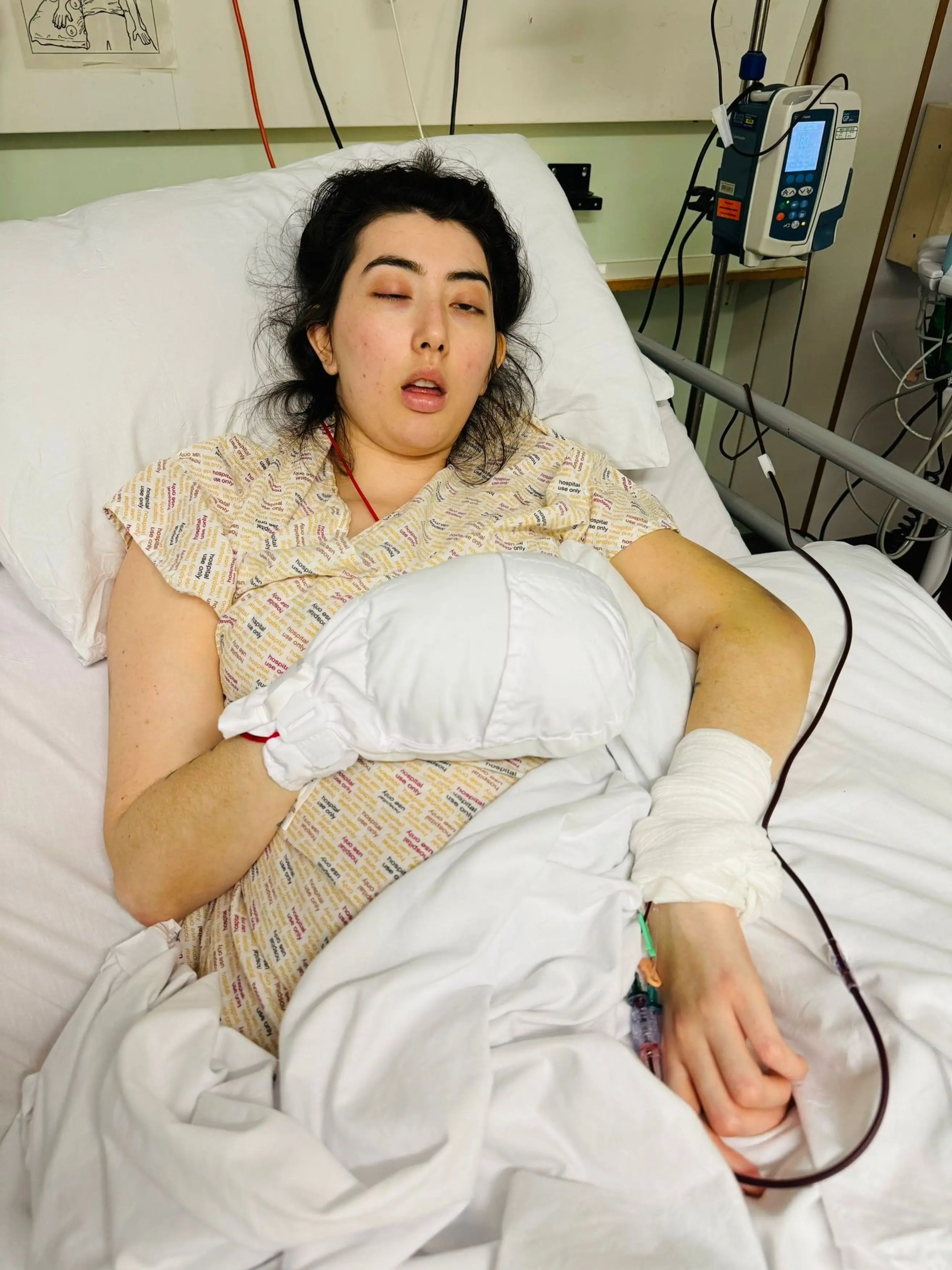 Cathy Warren woke up with a new accent (Kennedy News and Media)